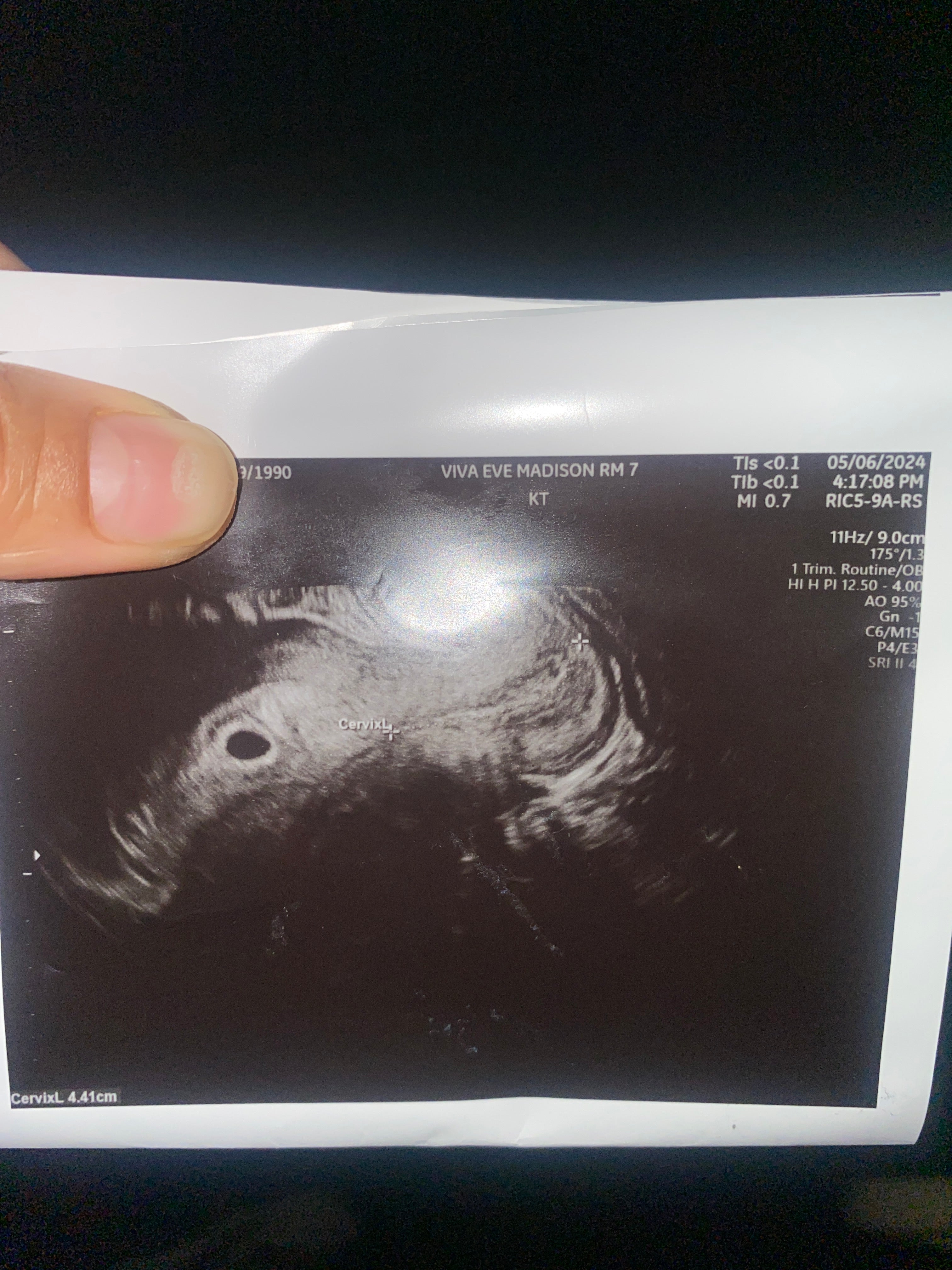 Ultrasound Picture