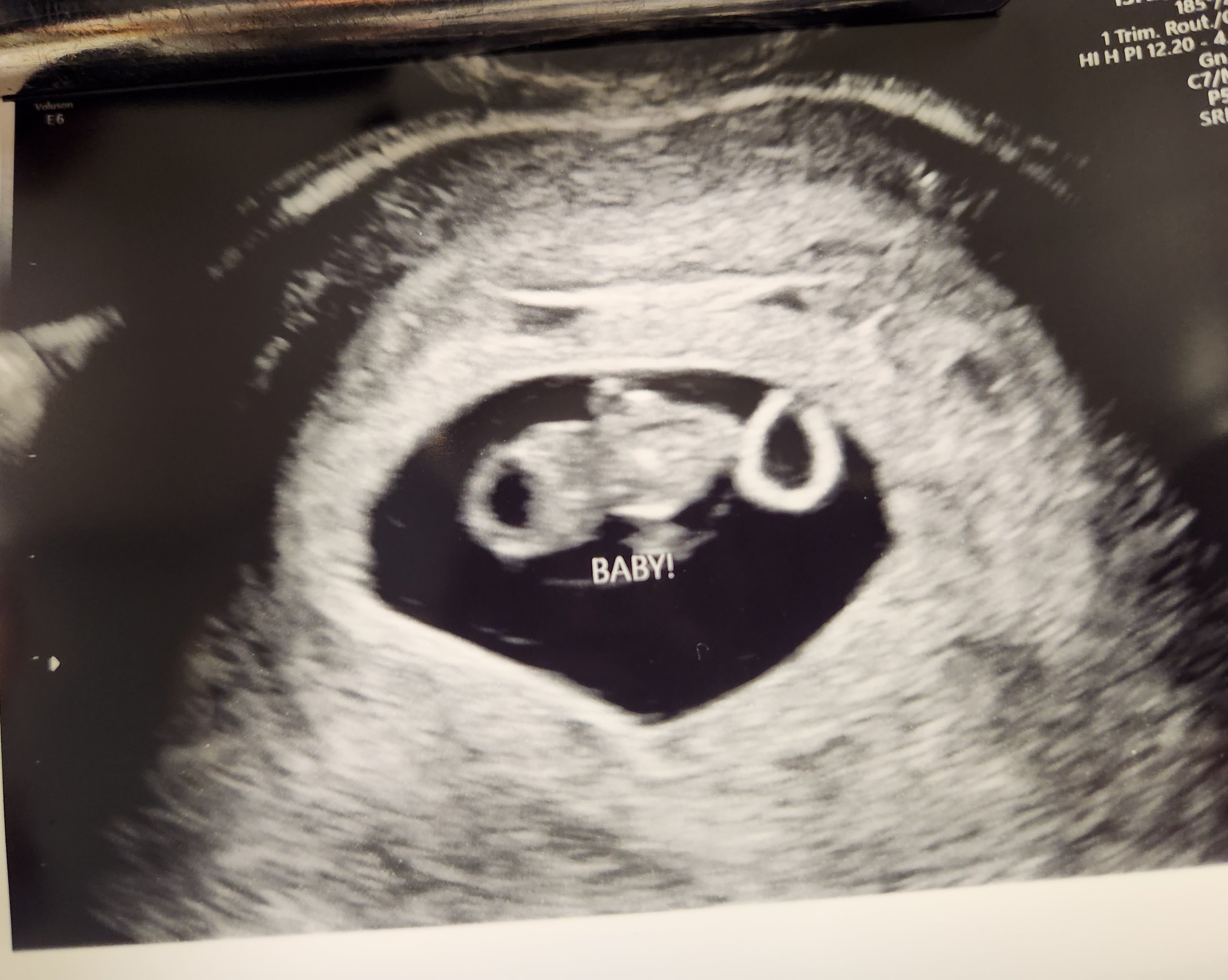 Ultrasound Image