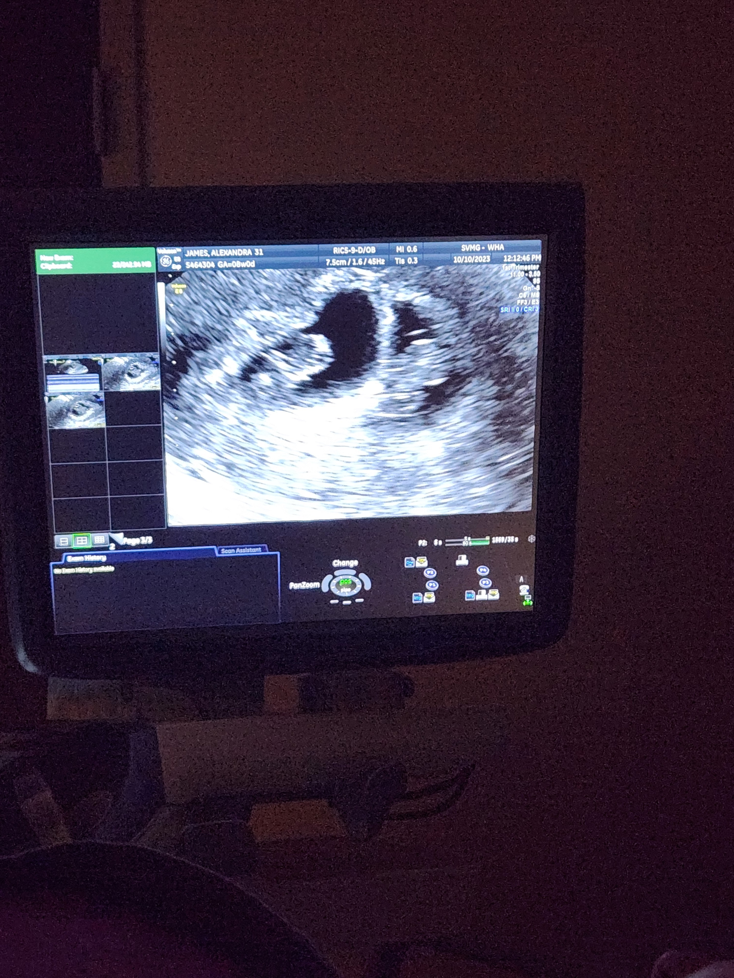 Ultrasound Picture